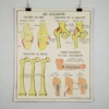 Scout Vintage French School Science Poster- Joints And Fractures 1 Scout Vintage French School Science Poster- Joints And Fractures